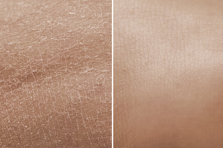 Dry Skin Kit